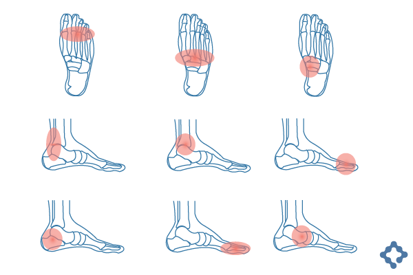 Lesiones mas frecuentes de pie y tobillo
