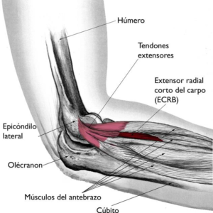 El músculo ECRB y el tendón usualmente están involucrados en el codo de tenista
Tomado y modificado de The Body Almanac. (c) American Academy of Orthopaedic Surgeons, 2003.
